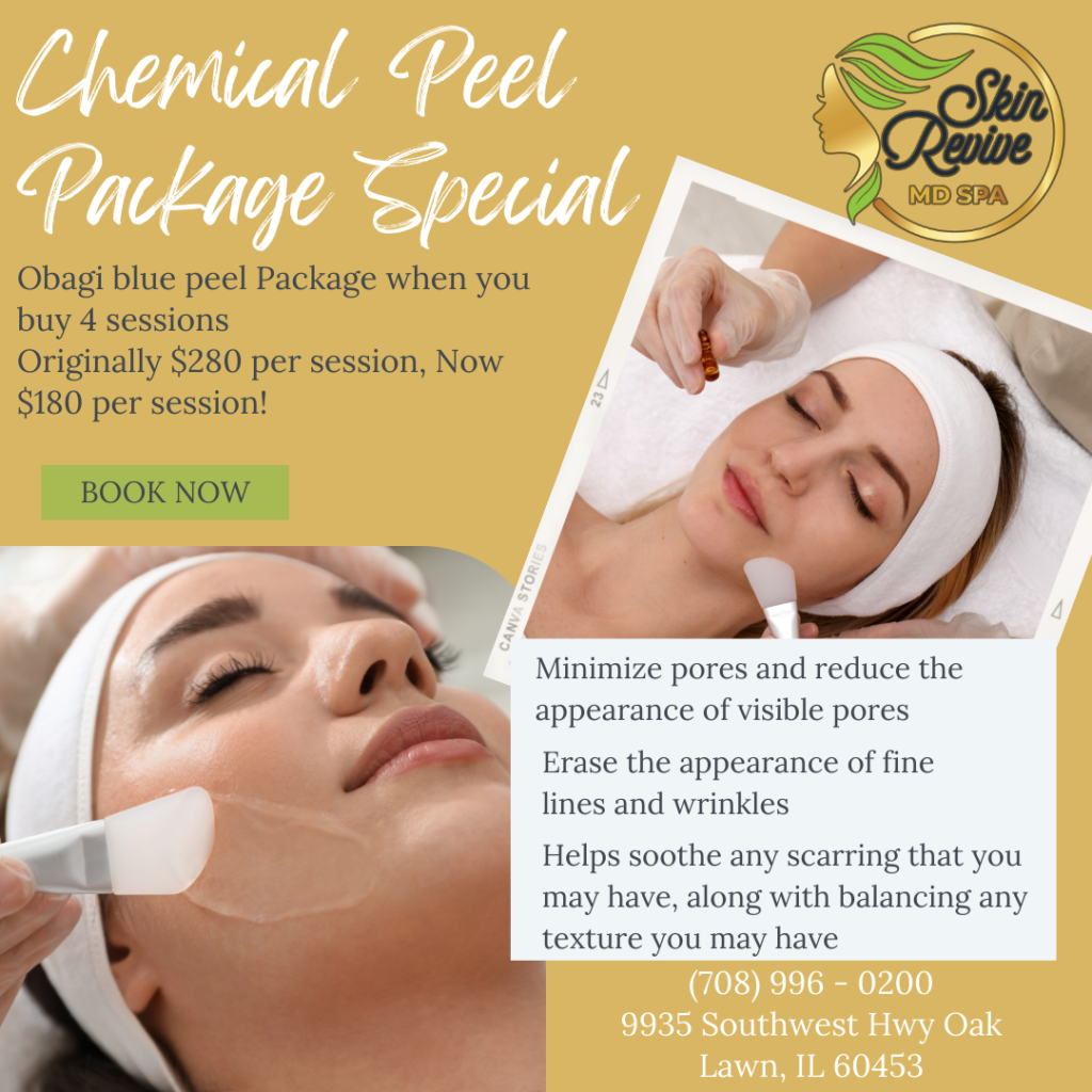 Chemical Peel Package Special, Oak Lawn, IL